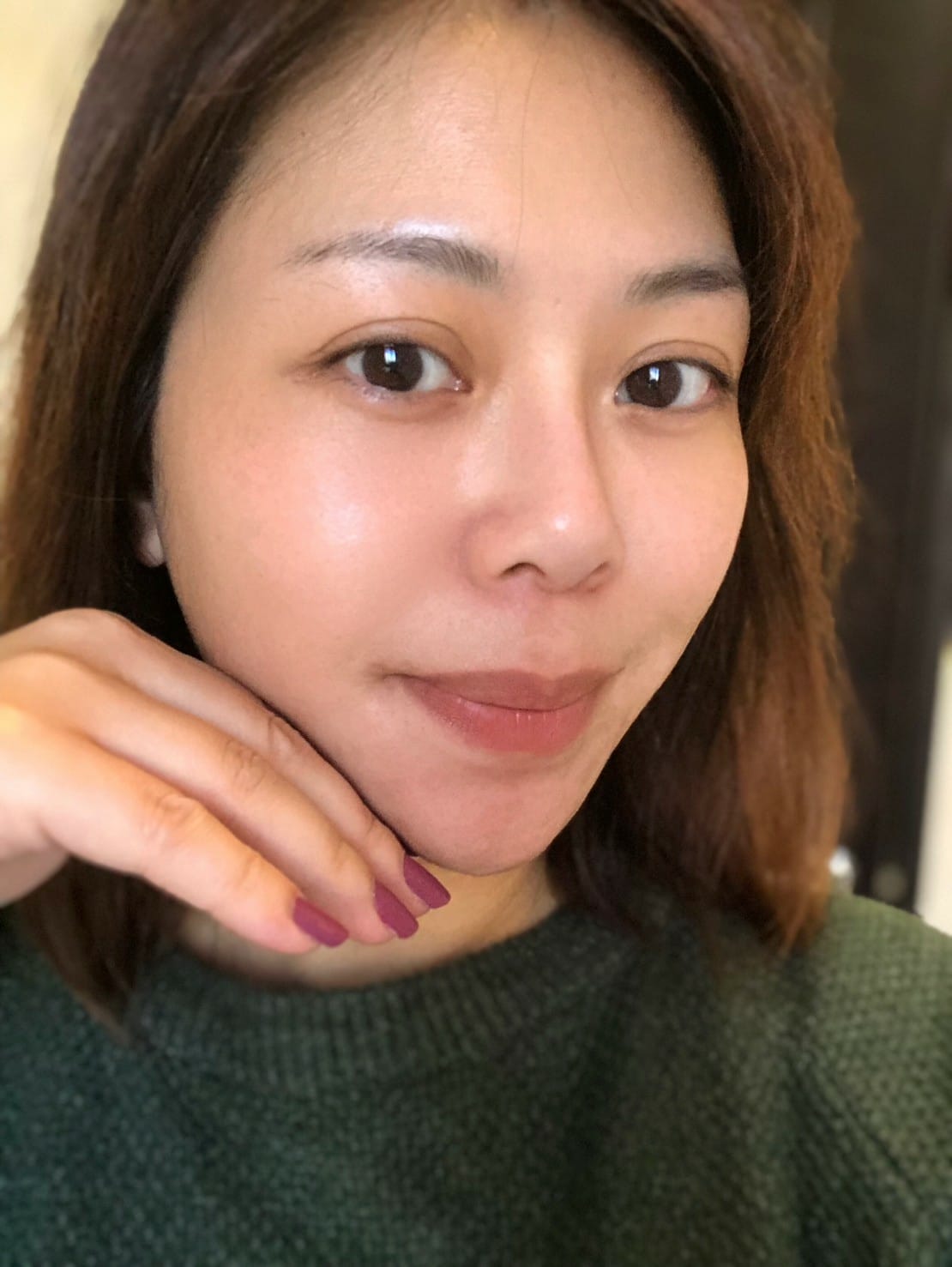 dr.yu22_07.jpg dr.yu22_07.jpg